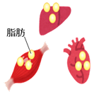 画像:異所性脂肪