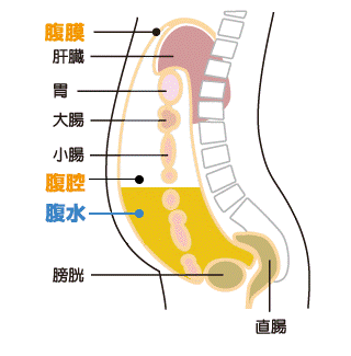 画像:腹水の基礎知識の図。腹膜、肝臓、胃、大腸、小腸、腹腔、腹水、膀胱、直腸の図解