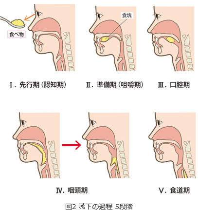 画像:図2 嚥下の過程 5段階 , 先行期(認知期) , 準備期(咀嚼期) , 口腔期 , 咽頭期 , 食道期