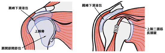 画像:五十肩の原因