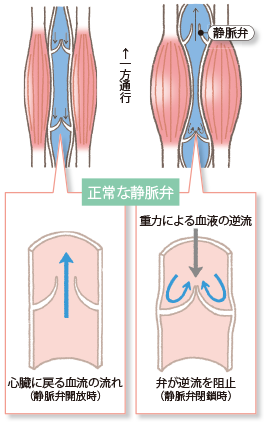 画像:正常な静脈弁