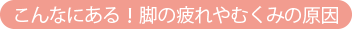 こんなにある!脚の疲れやむくみの原因